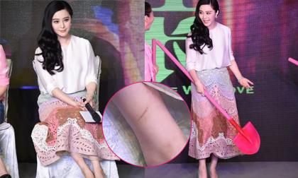 Phạm Băng Băng để lộ chân xước xát khi dự sự kiện