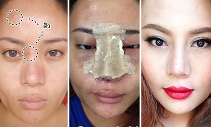 Cô gái lột xác nhờ thẩm mỹ mũi làm giới trẻ Thái Lan 'phát cuồng'
