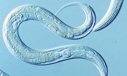 Phương pháp phát hiện ung thư đặc biệt nhờ giun và nước tiểu