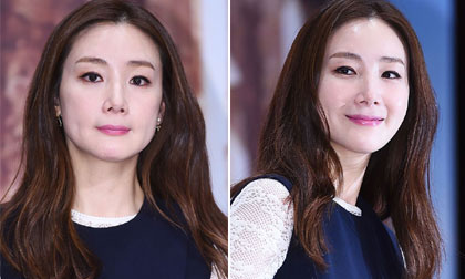 Choi Ji Woo khoe làn da đẹp không tì vết ở tuổi 40