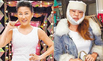 Ca sĩ Đài Loan U50 công khai ảnh phẫu thuật thẩm mỹ 'gây sốc'