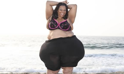 8 người mẫu nổi tiếng với vẻ ngoài đặc biệt