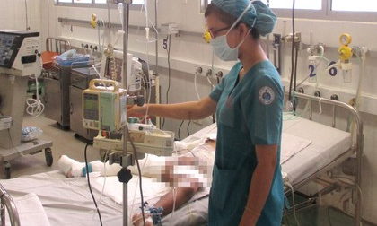 Bé bị cha đốt qua khỏi sốc bỏng, tiên lượng vẫn dè dặt