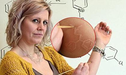 Bệnh lạ: Người phụ nữ có thể khắc chữ lên da