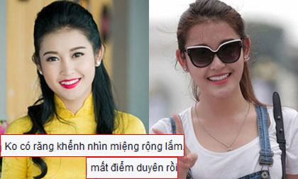 Á hậu Huyền My bị chê 'mất duyên' khi chỉnh răng khểnh