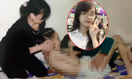 Nữ sinh bị người yêu đánh chấn thương sọ não vì ghen