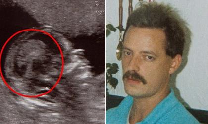Choáng khi thấy khuôn mặt người cha đã chết trong ảnh siêu âm thai nhi