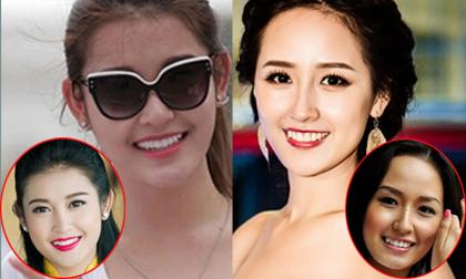 Mỹ nhân Việt khác lạ khi 'mất' răng khểnh