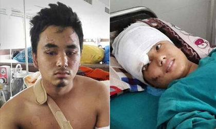 Động đất Nepal: Cặp tình nhân rơi từ tháp 60m thoát chết kỳ diệu