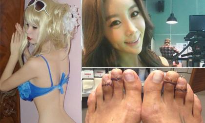 Trào lưu phẫu thuật thẩm mỹ 'cắt xương sườn, rút xương chân' rùng rợn