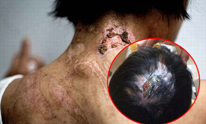 Cô gái nghèo bị dị tật do bà chủ đánh đập dã man suốt 2 năm