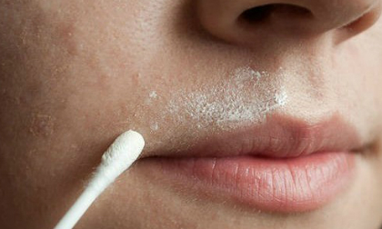 Cách tẩy lông mặt đơn giản vẫn 'siêu' hiệu quả