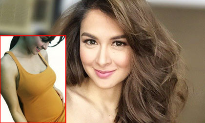 'Mỹ nhân đẹp nhất Philippines' lần đầu khoe bụng bầu