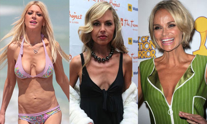 Top 10 ngôi sao 'siêu' gầy của Hollywood