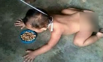 Lấy dây buộc cổ con như dắt chó gây bức xúc dư luận