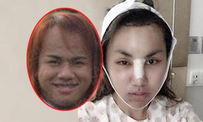 Cận cảnh quá trình chàng trai phẫu thuật thành nữ giới