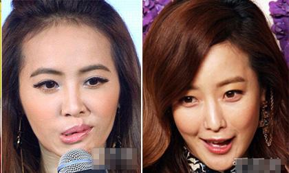 Những mỹ nhân 'dao kéo' khiến miệng 'méo xệch'