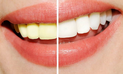 Chàng sẽ 'chạy mất dép' nếu bạn có kiểu làm đẹp này...