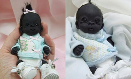 Sự thật bàng hoàng về em bé Nam Phi đen nhất thế giới