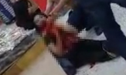 Kinh hoàng cảnh thiếu nữ bị tên trộm cắt cổ họng trong siêu thị
