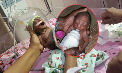 Bé 2 tuần tuổi bị cha mẹ bỏ rơi vì da nhăn như 70 tuổi