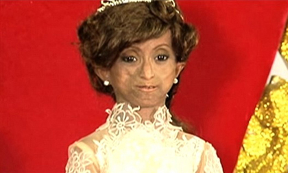 Cô gái Philippines bị 'mắc kẹt' trong cơ thể của bà lão 144 tuổi