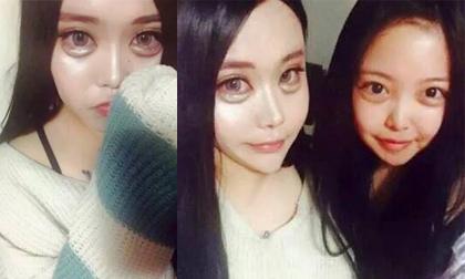 Kinh dị với cô gái mặt ếch vì chạy theo trào lưu mắt búp bê