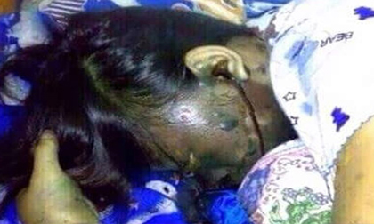 Cô gái bị chết cháy đen đáng sợ vì đeo tai nghe