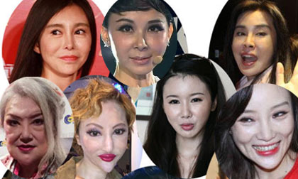 Sao Hoa ngữ hủy hoại nhan sắc vì thẩm mỹ