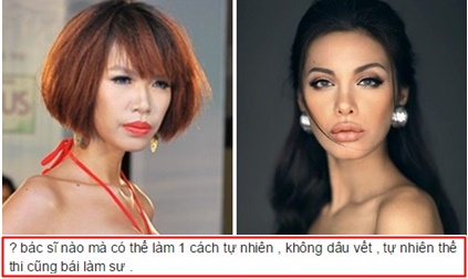 Mẫu Việt giống Angelina Jolie phủ nhận tin đồn 'dao kéo'