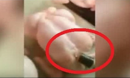 Hãi hùng thịt gà bị tiêm nước trước khi được đem bán
