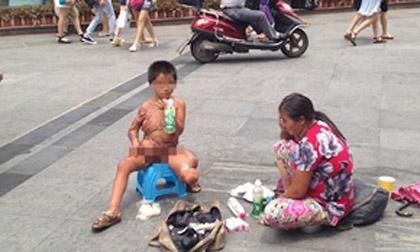 Cậu bé người đầy sẹo vì bỏng, đi ăn xin để chữa bệnh