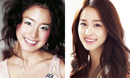 Hé lộ ảnh thời 'quê mùa' gây chú ý của Kim Tae Hee