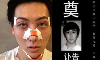 Chàng thiếu gia thẩm mỹ nghi tự tử vì phẫu thuật hỏng