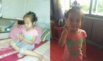 Bé 4 tuổi đã bị khối u buồng trứng ác tính