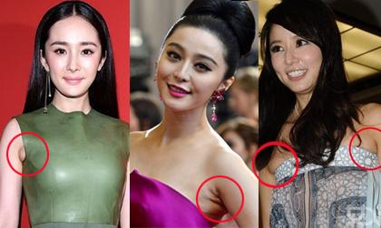 Sao Hoa ngữ lộ hõm nách xấu xí dấy nghi vấn thẩm mỹ