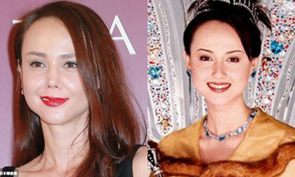 Hoa hậu đẹp nhất châu Á lộ khuôn mặt méo mó do phẫu thuật hỏng