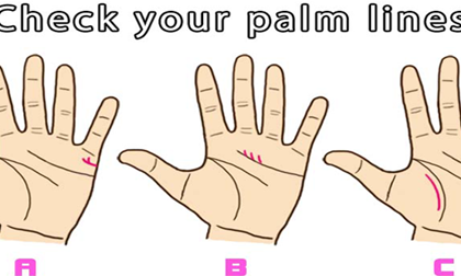 Lòng bàn tay 'tiết lộ' thời điểm kết hôn của bạn