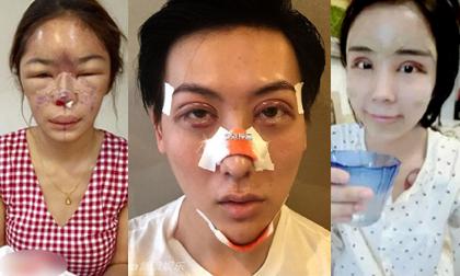 Loạt trường hợp nổi tiếng oái oăm nhờ thẩm mỹ hỏng