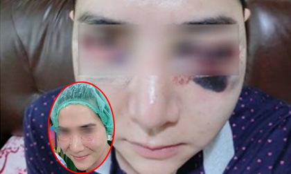 Chàng trai trẻ Thái Lan biến dạng khuôn mặt vì nâng má