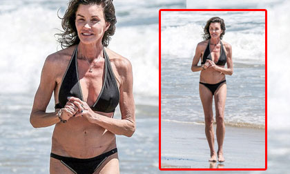 'Thảm họa thẩm mỹ' Janice Dickinson tự tin khoe thân hình nhăn nhúm