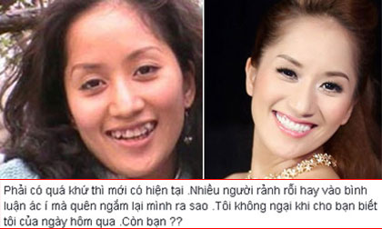 Khánh Thi 'phản pháo' những lời ác ý về răng xấu trong quá khứ