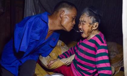 Người nông dân cụt cả 2 tay vẫn tận tụy chăm sóc mẹ liệt giường