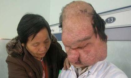 Những con người có hình thù quái dị nhất hành tinh