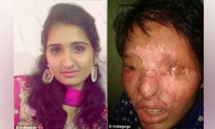 Biến thành 'quái vật' vì bị anh rể tạt axit nát mặt