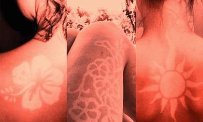 Nguy hiểm khi xăm hình từ vết bỏng nắng