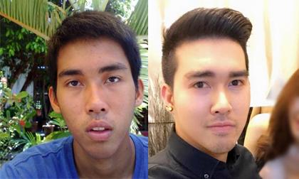 Chàng trai 'lột xác' thành hotboy sau phẫu thuật thẩm mỹ