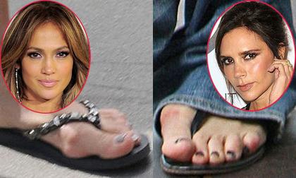 Hàng loạt Sao Âu bị lộ bàn chân 'dị dạng' vì giày