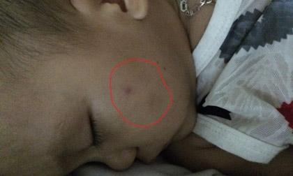 Kinh hoàng: Bé 15 tháng bị 3 giáo viên đánh, trói, nhét giẻ vào mồm