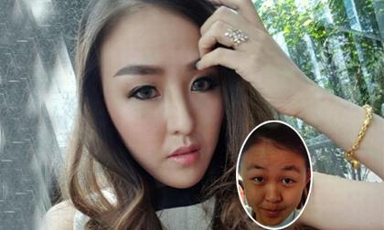 Bà mẹ đơn thân bỗng 'nổi như cồn' sau khi phẫu thuật thẩm mỹ